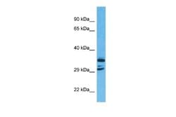 C11orf65 Rabbit anti-Human, Polyclonal, Novus Biologicals 0.1ml; Unconjugated:Antibodies,